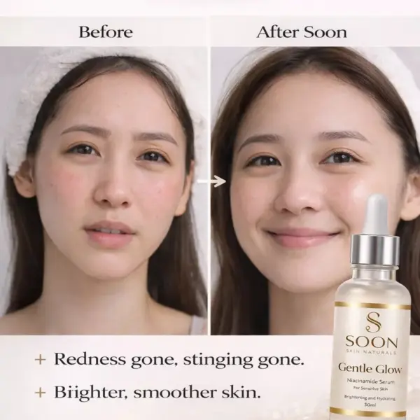 SOON SKIN NATURALS SERUM – Hydrating & Brightening Face Serum | Lightweight Daily Skincare